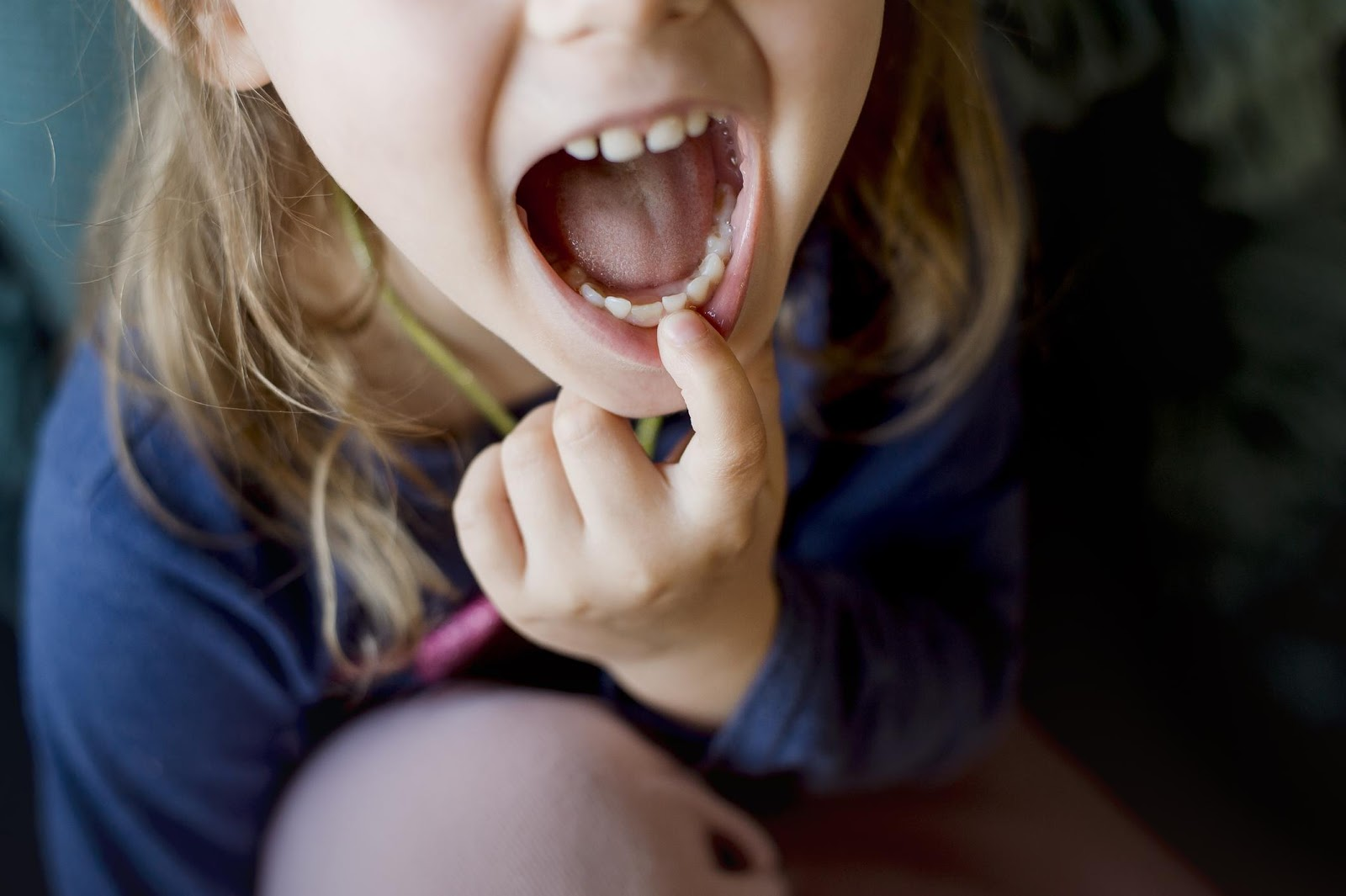 Baby Teeth: Should They Be Removed? | Providence RI Pediatric Dentist